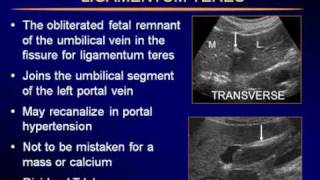 Sonography of the LiverP2flv [upl. by Shig]