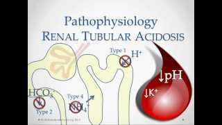 Renal Tubular Acidosis  USMLE STep 2 Review [upl. by Norraa]