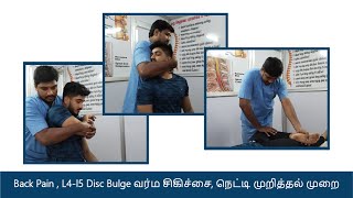 Varma treatment Back pain  L4L5 disc bulge  வர்மசிகிச்சைநெட்டி முறித்தல் முறை [upl. by Torosian274]