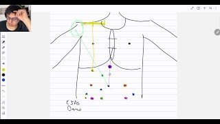 los puntos doloros del abdomen su localizacion y patologias [upl. by Wilen]