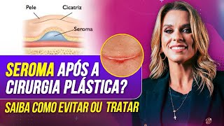 O Que Ninguém Te Conta Sobre Seromas no PósOperatório – Saiba Como Evitar [upl. by Hunsinger425]