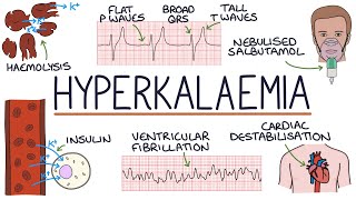 Understanding Hyperkalaemia High Potassium [upl. by Elleinnod]