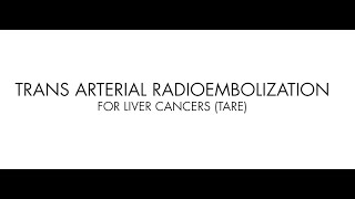 Radioembolization a cuttingedge treatment for liver cancer at its facility [upl. by Dalton]