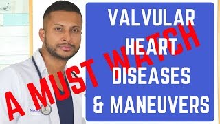 Heart Valve Murmurs amp ManeuversThe Best Explanation ever USMLE STEPs 1 2 amp 3 [upl. by Aicina457]