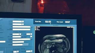 MRCP on GE 15T with n without respiratory getting full detailed sequence explanation [upl. by Pammie]