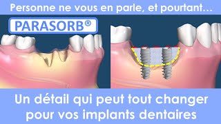 Implant dentaire  Comblement postextraction Parasorb [upl. by Hallette]