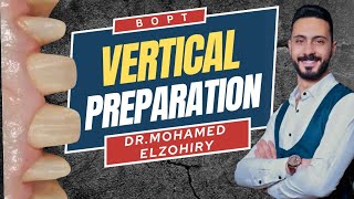 Vertical Preparation BOPT  Dr Mohamed Elzohiry [upl. by Vaughan]