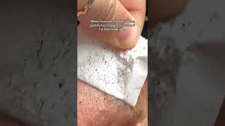 I had to step in and do a pore cleansing [upl. by Delora]