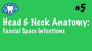 Head amp Neck Anatomy  Fascial Space Infections  INBDE [upl. by Primaveras]