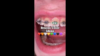 Braces Color Ideas  What is the best color for braces  Tooth Time Family Dentistry New Braunfels [upl. by Amitaf]