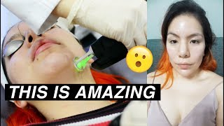 I tried two Korean laser treatments and Im shook  Korean Skin Treatment [upl. by Banks]