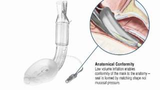 Features of the LMA Supreme™ [upl. by Hilda]