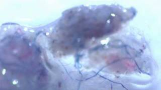 Morgellons organism  200x [upl. by Adnuhsar]