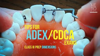 Class III Prep Dimensions size of cavities and parameters [upl. by Bhayani]