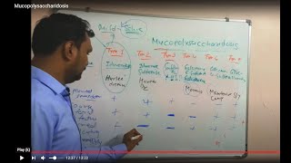 Mucopolysaccharidosis  clinical features of mucopolysaccharidosis  Biochemistry [upl. by Christenson]