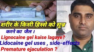 Topical anesthesia  सुन्न करने की दवा Lignocaine Hydrochloride Gel iplidocaine 2 jelly uses [upl. by Maia690]