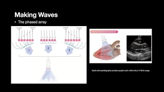 The Physics of echocardiography How I learned to love AS [upl. by Ttenaj]