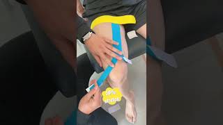 Use kinesiology tape for knee patellar pain lateral knee pain quadriceps pain and thigh pain [upl. by Brass]