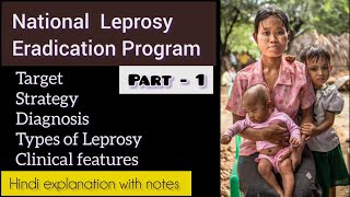 National Leprosy Eradication Program  Diagnosis amp Types of Leprosy  psm community norcet nurse [upl. by Hamas]