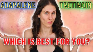 Adapalene vs Tretinoin  Which Is The Best ANTIACNE and ANTIAGING Ingredient [upl. by Lulu]