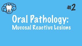 Oral Pathology  Mucosal Reactive Lesions  INBDE ADAT [upl. by Scarrow]