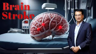 Understanding Brain Strokes Effects Symptoms amp Treatment  Expert Insights with Dr Praveen Gupta [upl. by Carlota]