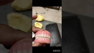 Soft Acrylic Denture [upl. by Eiramac]