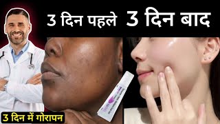 Skin Lite Cream Review 2024 in Hindi  Side Effects Uses and Result  गोरेपन की क्रीम Best Cream [upl. by Anny]