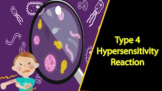 Type 4 Hypersensitivity Reaction  Microbiology [upl. by Viviyan]