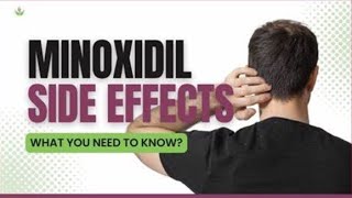 How does Minoxidil works What is the effect of Minoxidil Hair cream for hair growth Hair Growth [upl. by Shannon995]