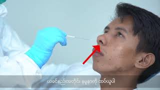 Sample Collection Oropharyngeal Swab amp Nasopharyngeal Swab [upl. by Ula]