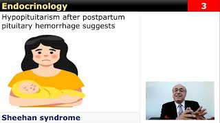 USMLE Step 2  Endocrinology 1 Flash Card Review [upl. by Viviane62]