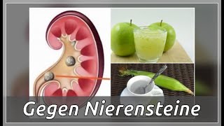 5 nützliche Hausmittel gegen Nierensteine  Besser Gesund Leben [upl. by Gnol]