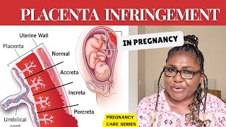 PLACENTA INVASION IN PREGNANCY  Placenta Accreta Placenta Increta amp Placenta Percreta [upl. by Blayze]