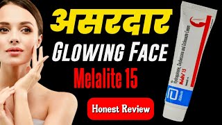 Melalite 15 Cream Review  No Side Effects Skin Whitening Cream  Hydroquinone For Skin Whitening [upl. by Stieglitz]