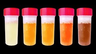 7 Choses Que Ton Urine Peut Révéler Sur ta Santé [upl. by Julis]