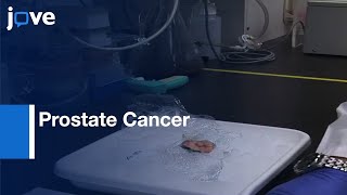 Real Time PCR qPCR for MicroRNA Detection in Prostate Cancer  Protocol Preview [upl. by Adnauqal]