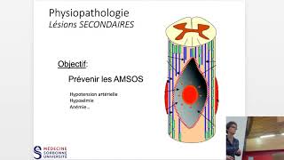 Traumatismes médullaires [upl. by Dressler]