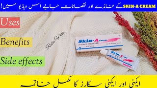 SkinA Cream Uses Benefits and Side effects Review  How to use SkinA cream  Tretinoin 005 [upl. by Navnod]