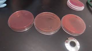 Macconkey Agar [upl. by Hazaki702]