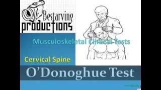 ODonoghue Test Musculoskeletal Clinical Tests [upl. by Joliet]