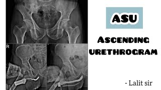 Ascending urethrogram  ASU  scparamedicalinstitute8221 [upl. by Toiboid]