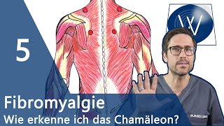 Fibromyalgie 5 sichere Anzeichen dass Sie am Fibromyalgie Syndrom FMS erkrankt sind [upl. by Annaek]