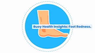 Understanding Foot Redness Common Causes and When to Seek Medical Care  BuoyHealthcom [upl. by Yahsan]