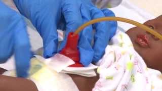 Caring for My Child with a Gastrostomy Tube  St Louis Childrens Hospital [upl. by Corabella228]