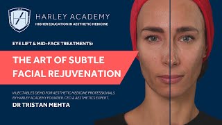 Eye Lift amp MidFace Filler Subtle Facial Rejuvenation Aesthetics Treatment Demo by Dr Tristan Mehta [upl. by Aneleh]