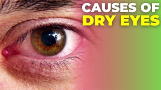 What Causes Eye Floaters and Dry Eyes [upl. by Anneirb317]