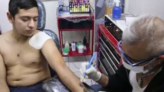 eliminación de tatuaje usando un electrobisturí [upl. by Aisaim]