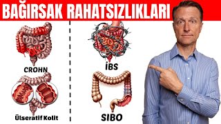 Bağırsak Rahatsızlıkları Crohn İBS Ülseratif Kolit SIBO İçin En Kolay Test  DrBerg Türkçe [upl. by Verena264]