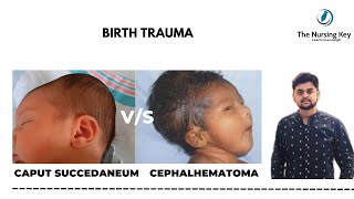 Caput Succedaneum Vs Cephalhematoma  Pediatric Nursing  Shivam Mandal  The Nursing Key [upl. by Audly905]